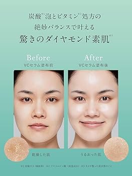Amazon | Dr.Syuwan ドクターシュワン | マイクロバブルVC